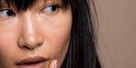 BLEMISHES
