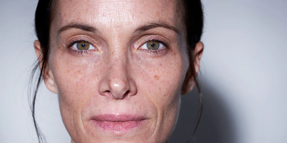 SENSITIVE SKIN