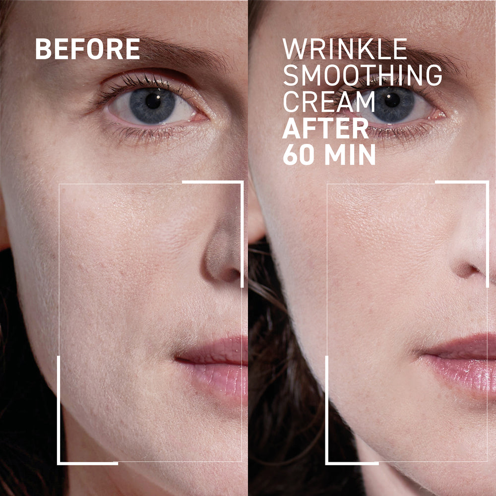 NEEDLES NO MORE <br> WRINKLE SMOOTHING CREAM 2.0