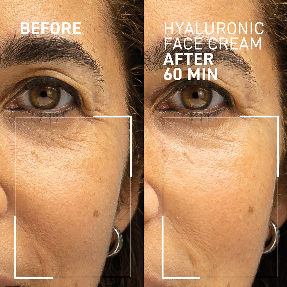 NEEDLES NO MORE <br> HYALURONIC FACE CREAM 2.0