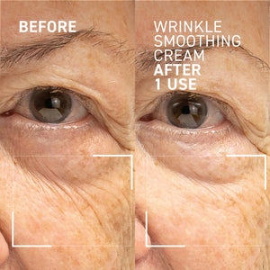 NEEDLES NO MORE <br> WRINKLE SMOOTHING CREAM 2.0