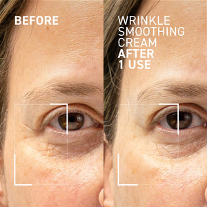 NEEDLES NO MORE <br> WRINKLE SMOOTHING CREAM 2.0