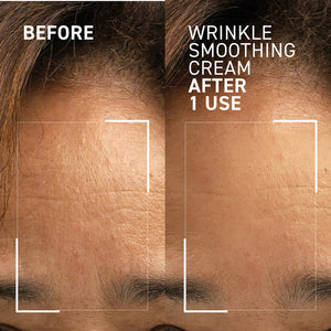 NEEDLES NO MORE <br> WRINKLE SMOOTHING CREAM 2.0