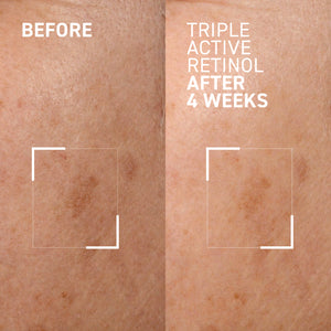 BRIGHT THIS WAY <br> TRIPLE ACTIVE RETINOL