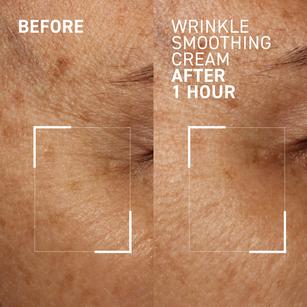 NEEDLES NO MORE <br> WRINKLE SMOOTHING CREAM